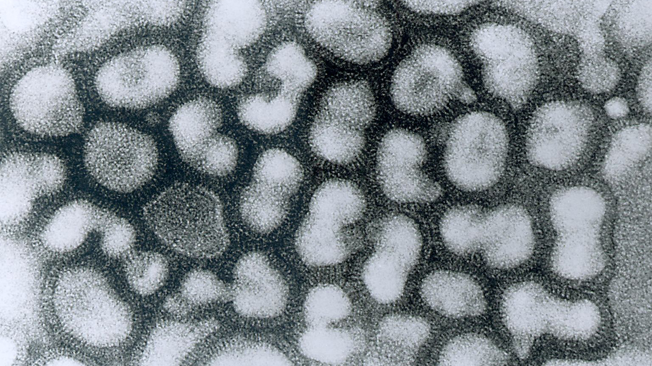 Influenza shuts down classes at Kelton ISD; Texas activity remains 'widespread'