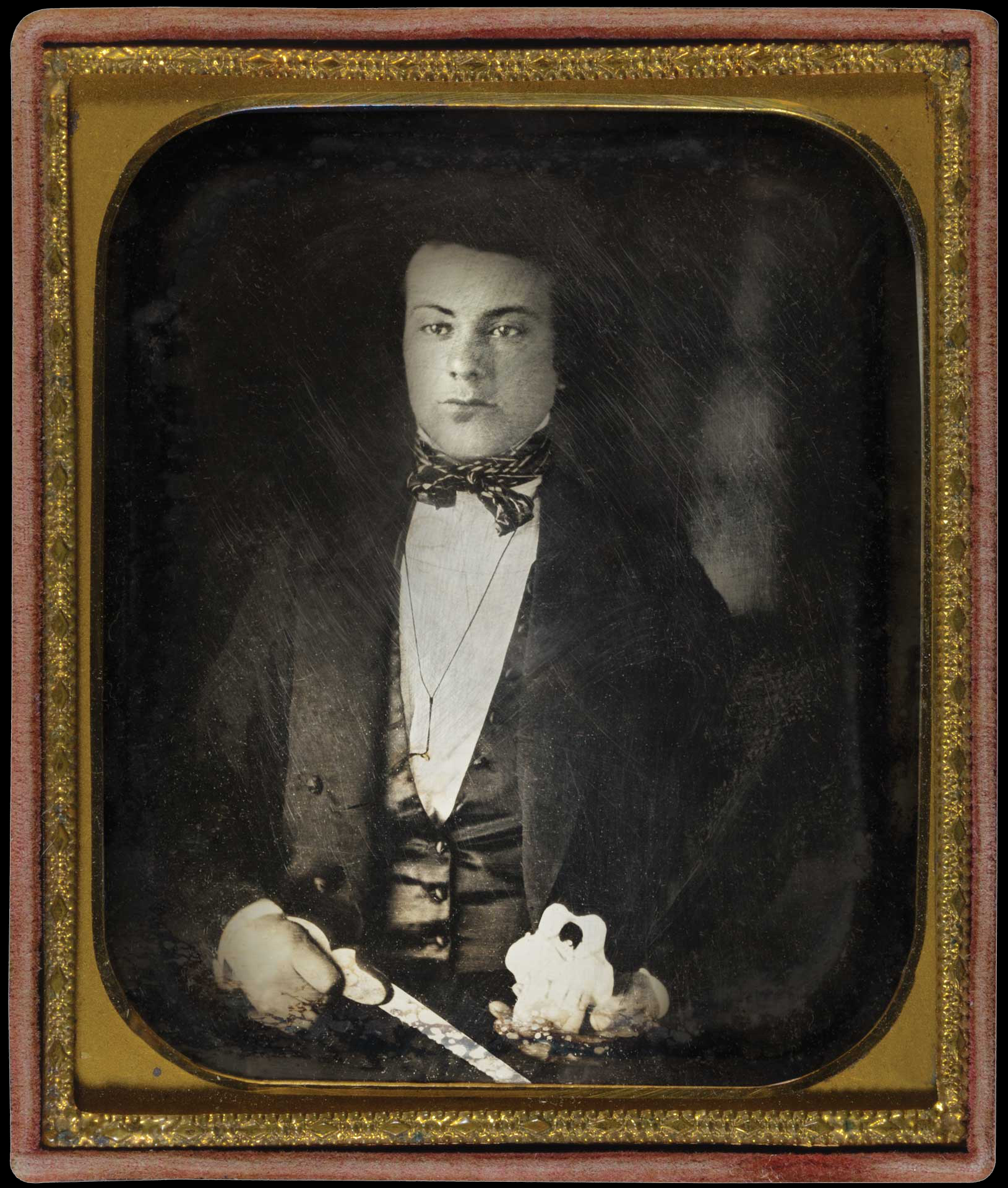 Civil War Medical Practice | Behind the Lens: A History in Pictures ...