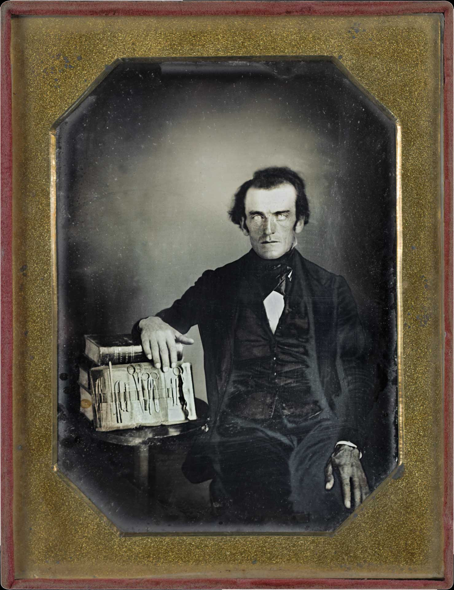 Civil War Medical Practice Behind the Lens A History in Pictures